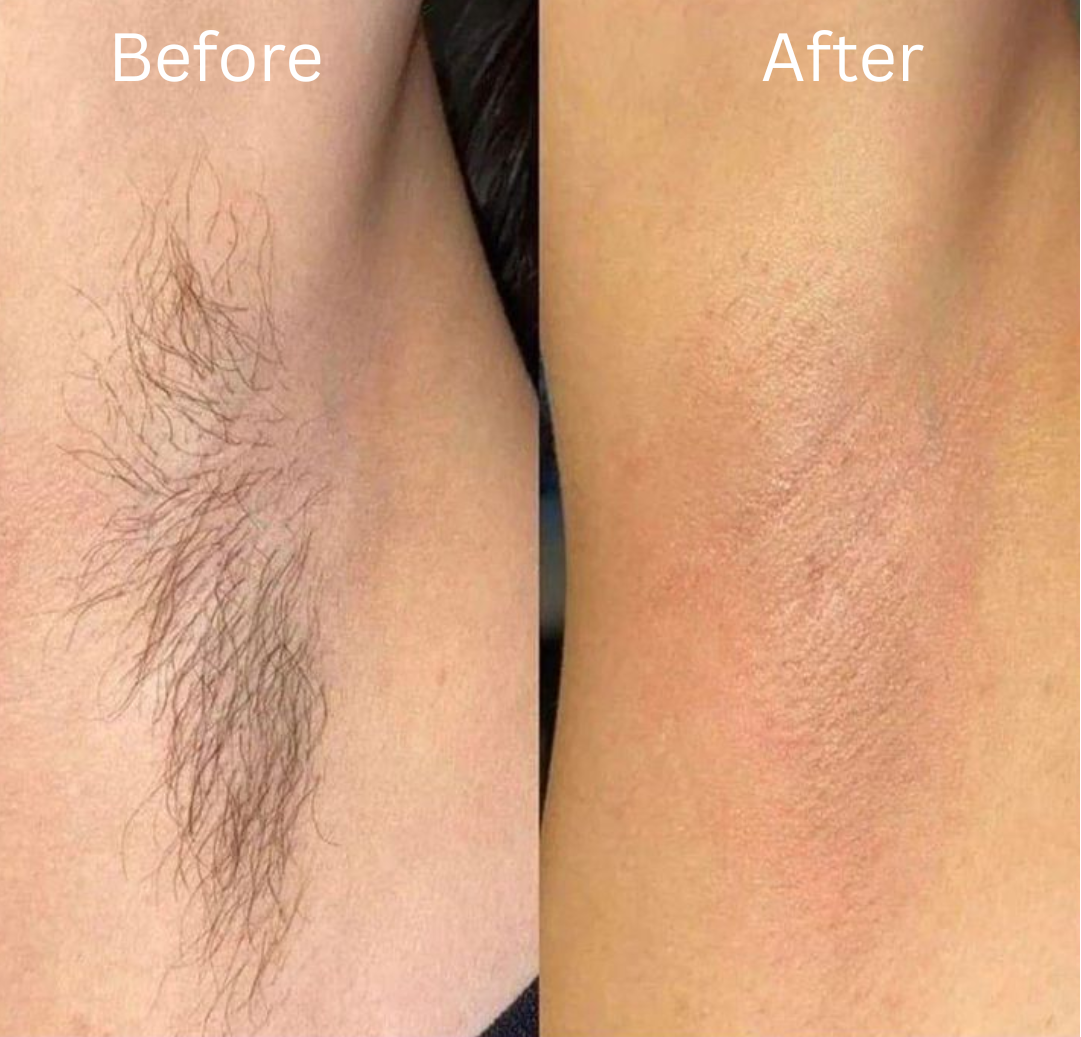 Flawless Trim™