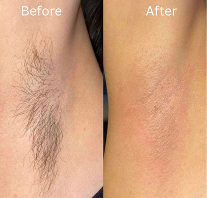 Flawless Trim™